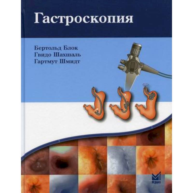См Клиника Гастроскопия Цена