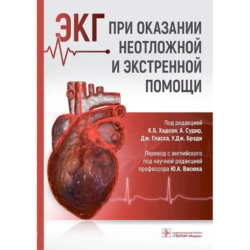 ЭКГ при оказании неотложной и экстренной помощи