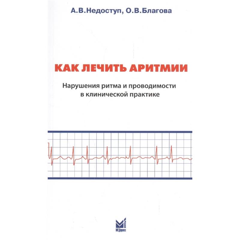 Как лечить аритмии. Нарушение ритма и проводимости в клинической практике