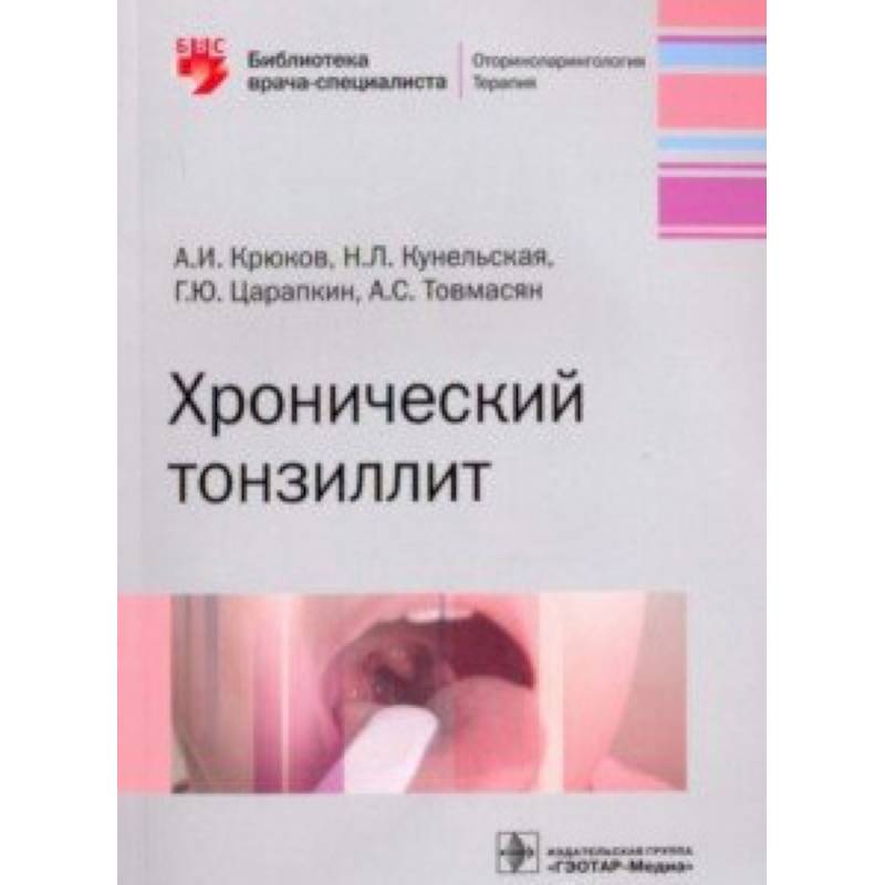 Хронический тонзиллит Хронический тонзиллит