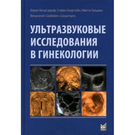 Акушерство и гинекология, книга Ультразвуковые исследования в гинекологии купить по скидке