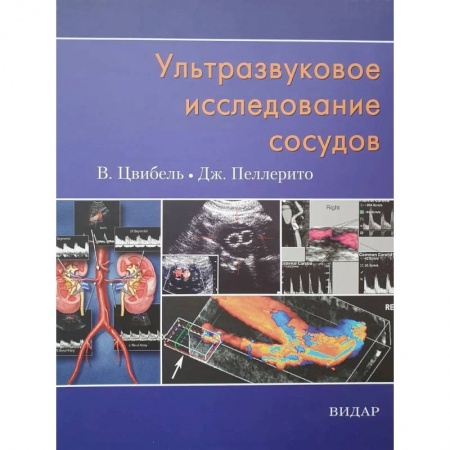 УЗИ. ЭКГ. Томография. Рентген, книга Ультразвуковое исследование сосудов купить по скидке