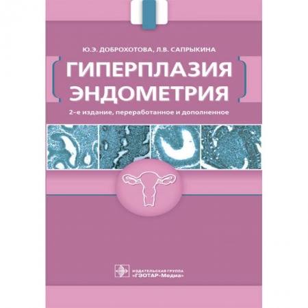 Акушерство и гинекология, книга Гиперплазия эндометрия купить по скидке