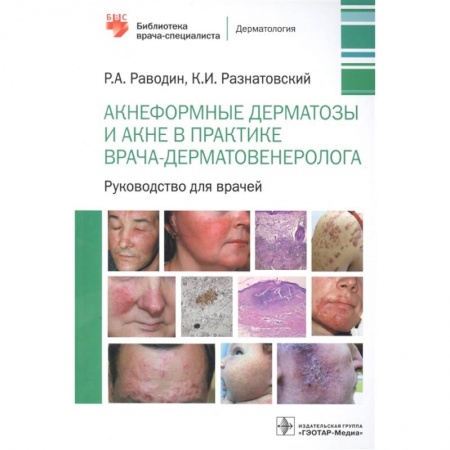 Медицина. Фармакология, книга Акнеформные дерматозы и акне в практике врача-дерматовенеролога: руководство для врачей купить по скидке