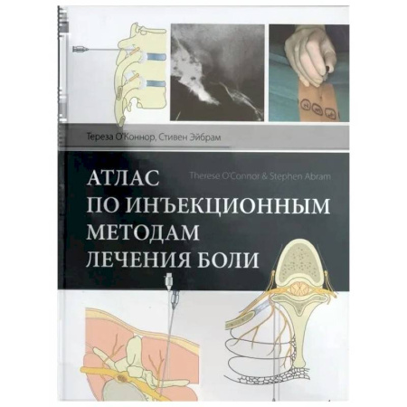 Онкология, книга Атлас по инъекционным методам лечения боли купить по скидке
