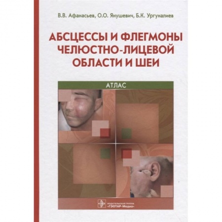 Другие болезни, книга Абсцессы и флегмоны челюстно-лицевой области и шеи купить по скидке