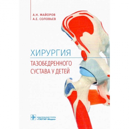 Хирургия. Ортопедия, книга Хирургия тазобедренного сустава у детей купить по скидке