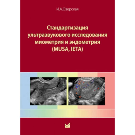 Акушерство и гинекология, книга Стандартизация ультразвукового исследования миометрия и эндометрия (MUSA, IETA). Учебное пособие купить по скидке
